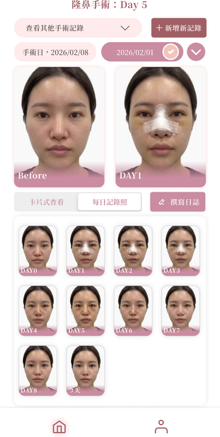 BeautyLog App — 節點式 BA 對比視覺化