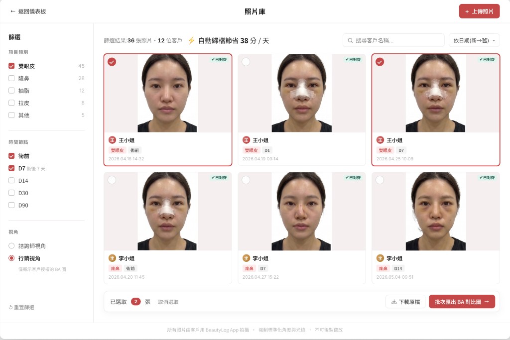 BeautyLog 後台照片庫儀表板:篩選項目與時間節點、行銷視角僅顯示授權 BA 圖、批次匯出對比